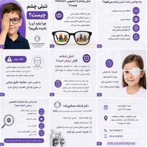 چرا نباید تنبلی چشم را نادیده بگیریم؟