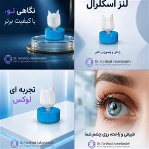 لنز اسکلرال ؛ نگاهی نو به راحتی و وضوح دید.