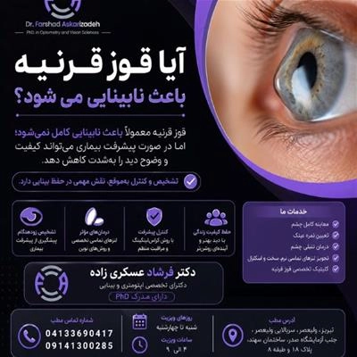 قوز قرنیه و نابینایی ؛ هر آنچه باید بدانید